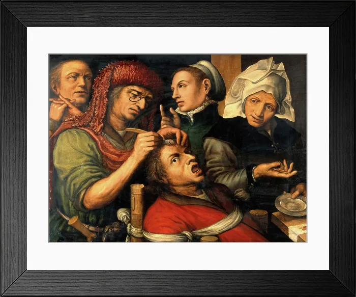 Framed Print : An operation for stone in the head. Creator: Follower of Jan Sanders van Hemessen Framed Print : An operation for stone in the head. Creator: Follower of Jan Sanders van Hemessen