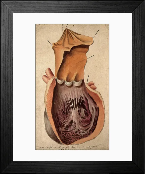 Framed Print : Dissected heart: section of the left ventricle, 1800-1899. Creator: Unknown Framed Print : Dissected heart: section of the left ventricle, 1800-1899. Creator: Unknown