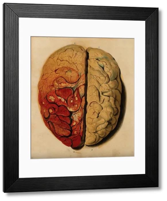 Framed Print : Brain: view from above, showing the gyri, with one hemisphere covered with pia mater, 1820-1827. Creator: Unknown Framed Print : Brain: view from above, showing the gyri, with one hemisphere covered with pia mater, 1820-1827. Creator: Unknown