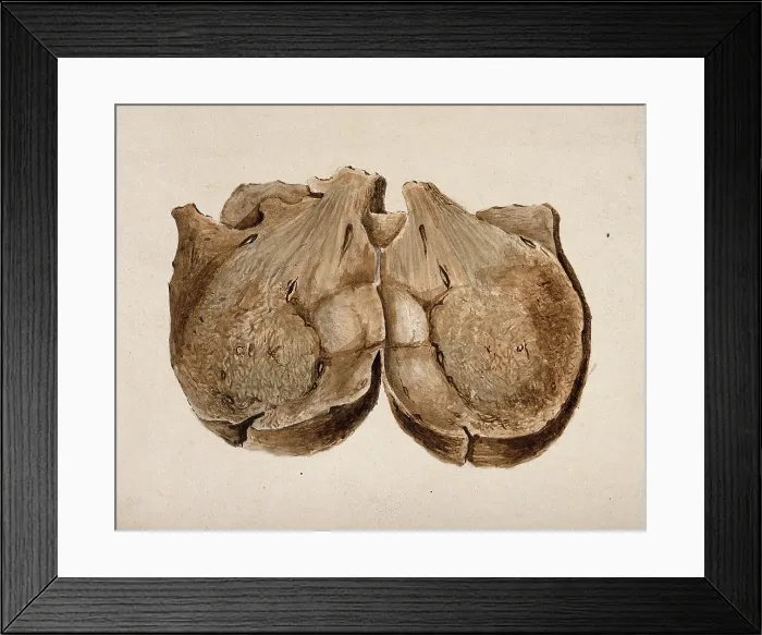 Framed Print : Section through polypus uteri, 1831. Creator: Unknown Framed Print : Section through polypus uteri, 1831. Creator: Unknown
