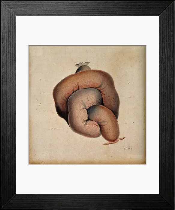 Framed Print : A length of coiled intestine, 1800-1899. Creator: Unknown Framed Print : A length of coiled intestine, 1800-1899. Creator: Unknown