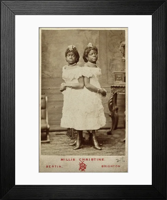 Framed Print : The Millie-Christine sisters, conjoined twins, standing, 1874. Creator: Bertin Framed Print : The Millie-Christine sisters, conjoined twins, standing, 1874. Creator: Bertin