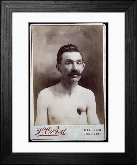 Framed Print : Reverend Eavens, a man with a hole in his chest, between 1800 and 1899. Creator: WC Bell Framed Print : Reverend Eavens, a man with a hole in his chest, between 1800 and 1899. Creator: WC Bell