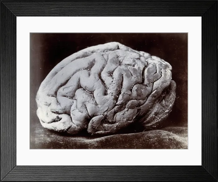Framed Print : A brain, viewed from the side, supposedly from a subject with mental deficiency. Creator: N. Goulton May Framed Print : A brain, viewed from the side, supposedly from a subject with mental deficiency. Creator: N. Goulton May