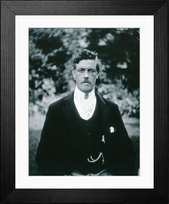 Framed Print : Gloucester smallpox epidemic, 1896: Edwin Davis, a smallpox patient, 1896. Creator: HCF of Gloucester