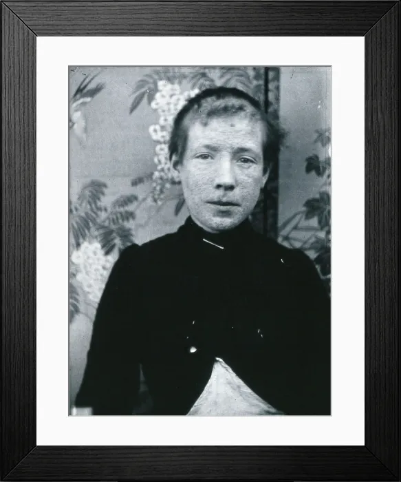 Framed Print : Gloucester smallpox epidemic, 1896: Ethel Cromwell, aged about 14 years, as a smallpox patient, 1896 Creator: HCF of Gloucester Framed Print : Gloucester smallpox epidemic, 1896: Ethel Cromwell, aged about 14 years, as a smallpox patient, 1896 Creator: HCF of Gloucester