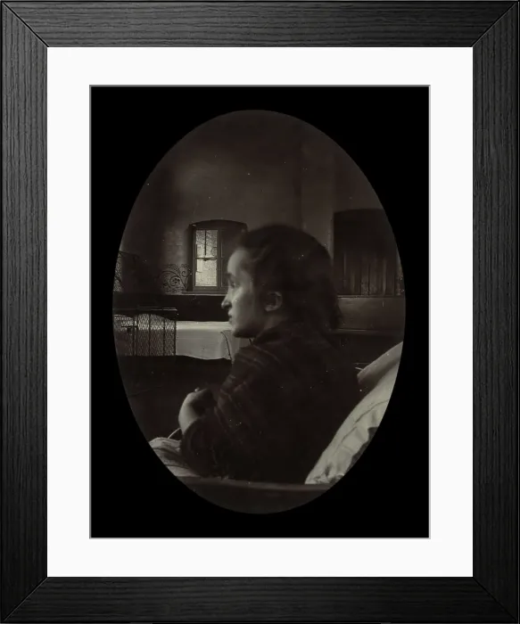 Framed Print : Side profile of a young woman with a misshapen head, wrapped in a tartan shawl, probably... Creator: Unknown Framed Print : Side profile of a young woman with a misshapen head, wrapped in a tartan shawl, probably... Creator: Unknown