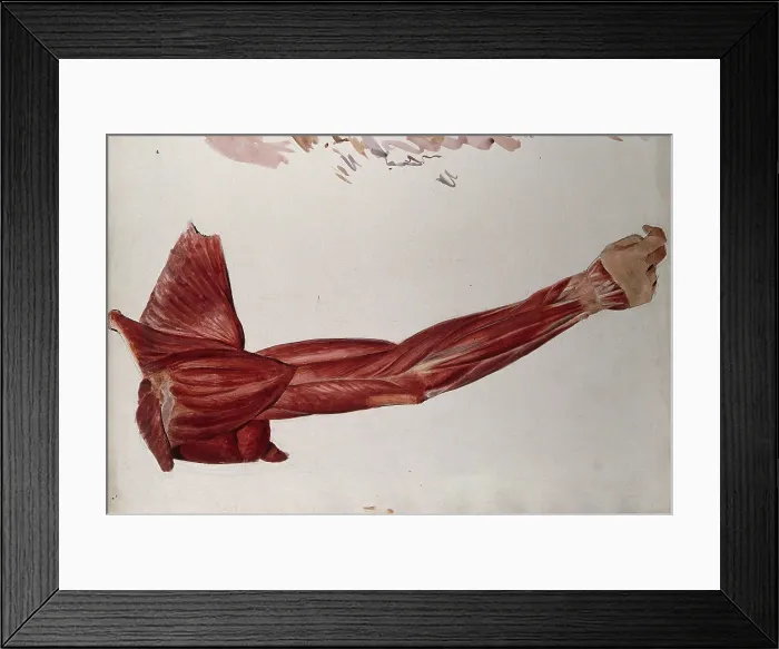 Framed Print : Dissection showing the muscles of the arm and shoulder, back view, (1833?). Creator: Johann Conrad Zeller Framed Print : Dissection showing the muscles of the arm and shoulder, back view, (1833?). Creator: Johann Conrad Zeller