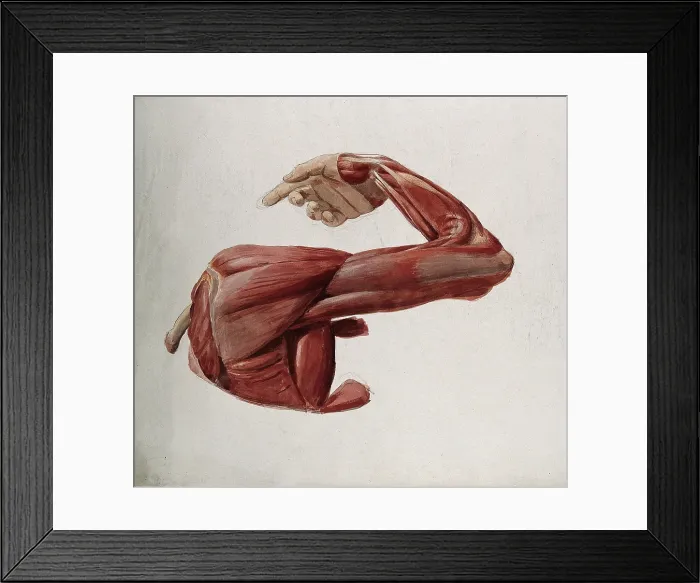 Framed Print : Dissection showing the muscles of the arm and shoulder, back view, with elbow and wrist... (1833?). Creator: Johann Conrad Zeller Framed Print : Dissection showing the muscles of the arm and shoulder, back view, with elbow and wrist... (1833?). Creator: Johann Conrad Zeller