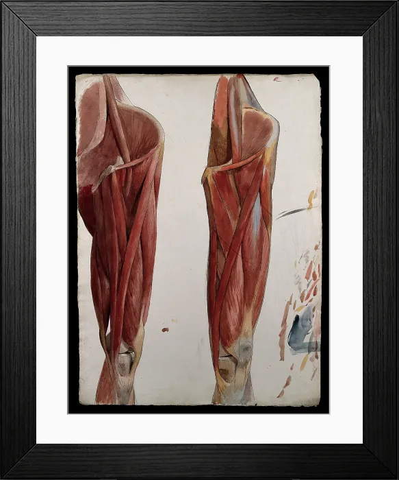 Framed Print : Two dissections showing the muscles of the thigh, hip, pelvis and knee, (1833?). Creator: Johann Conrad Zeller Framed Print : Two dissections showing the muscles of the thigh, hip, pelvis and knee, (1833?). Creator: Johann Conrad Zeller