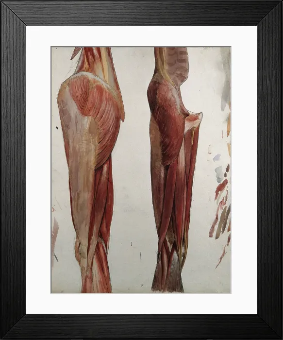 Framed Print : Two dissections showing the muscles of the thigh, hip, pelvis and knee, (1833?). Creator: Johann Conrad Zeller Framed Print : Two dissections showing the muscles of the thigh, hip, pelvis and knee, (1833?). Creator: Johann Conrad Zeller