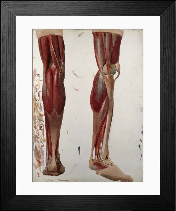 Framed Print : Two dissections showing the muscles of the leg, (1833?). Creator: Johann Conrad Zeller Framed Print : Two dissections showing the muscles of the leg, (1833?). Creator: Johann Conrad Zeller