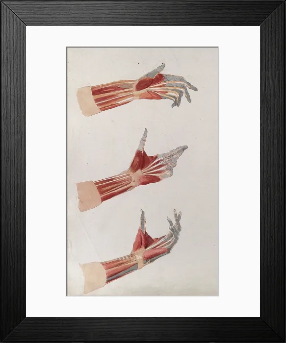 Framed Print : Three dissections of the left hand and wrist, showing the muscles and tendons, (1833?). Creator: Johann Conrad Zeller Framed Print : Three dissections of the left hand and wrist, showing the muscles and tendons, (1833?). Creator: Johann Conrad Zeller