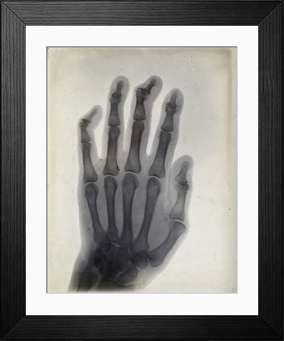 Framed Print : The bones of a hand, viewed through x-ray, 1895 Framed Print : The bones of a hand, viewed through x-ray, 1895