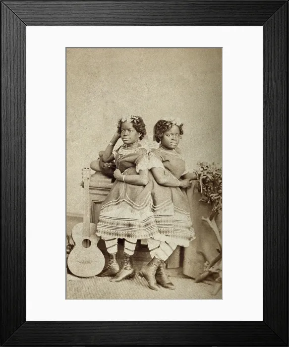 Framed Print : The Millie-Christine sisters, conjoined twins, standing, c1871. Creator: Unknown Framed Print : The Millie-Christine sisters, conjoined twins, standing, c1871. Creator: Unknown