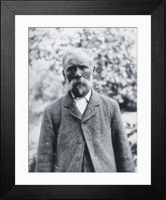 Framed Print : Gloucester smallpox epidemic, 1896: George Steel, a smallpox patient, 1896. Creator: HCF of Gloucester Framed Print : Gloucester smallpox epidemic, 1896: George Steel, a smallpox patient, 1896. Creator: HCF of Gloucester