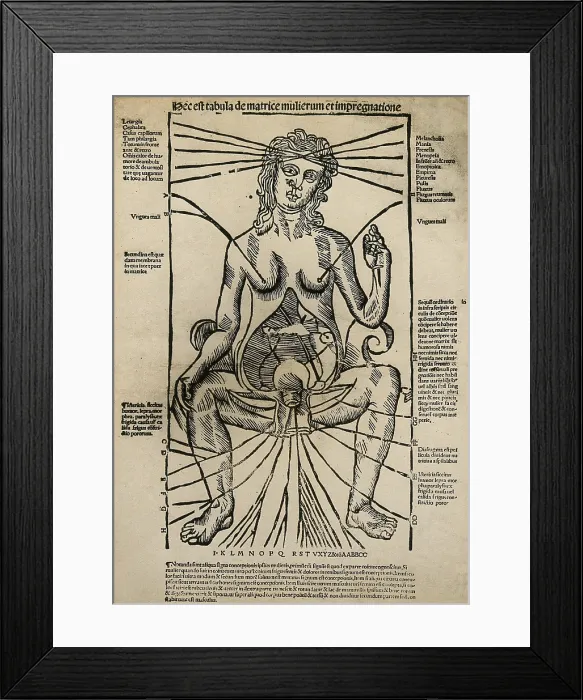 Framed Print : A seated female figure with a dissected abdomen, c1525-1530 (woodcut). Creator: Unknown Framed Print : A seated female figure with a dissected abdomen, c1525-1530 (woodcut). Creator: Unknown