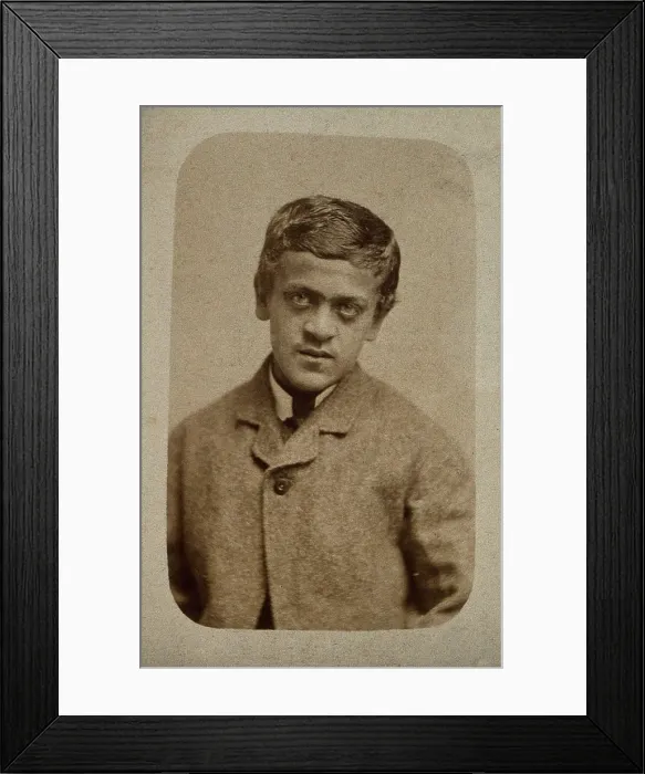Framed Print : A young man, probably showing some signs of Down's syndrome, c1880s. Creator: Davis & Sons. A young man, probably showing some signs of Down's syndrome, c1880s Framed Print : A young man, probably showing some signs of Down's syndrome, c1880s. Creator: Davis & Sons. A young man, probably showing some signs of Down's syndrome, c1880s