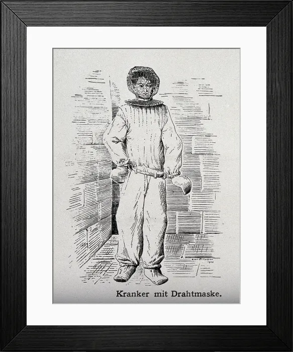 Framed Print : A mentally ill patient with mask and hand restraints, 1908. Creator: Unknown Framed Print : A mentally ill patient with mask and hand restraints, 1908. Creator: Unknown