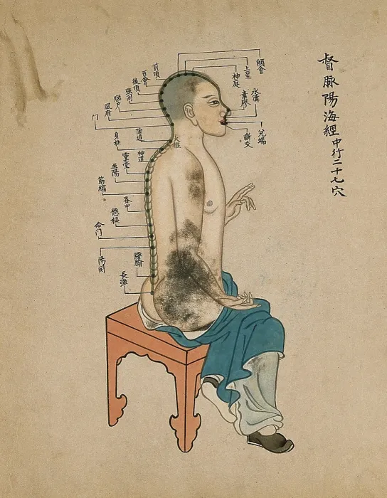 Framed Print : Acupuncture chart with a series of points indicated on the figure of a seated Chinese man, 1700-1799 Creator: Unknown Framed Print : Acupuncture chart with a series of points indicated on the figure of a seated Chinese man, 1700-1799 Creator: Unknown