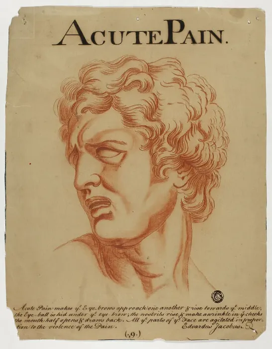 Framed Print : Acute Pain, after 1698. Creator: Eduardus Jacobus Framed Print : Acute Pain, after 1698. Creator: Eduardus Jacobus