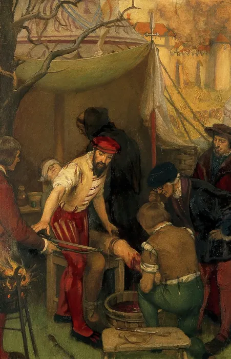 Framed Print : Ambroise Pare using the ligature when amputating at the siege of Damvillers, 1552, c1912. Creator: Ernest Board Framed Print : Ambroise Pare using the ligature when amputating at the siege of Damvillers, 1552, c1912. Creator: Ernest Board