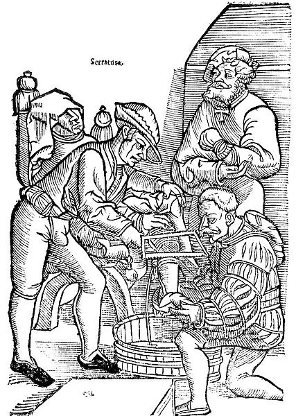 Amputation of a leg without anaesthetic, 1593