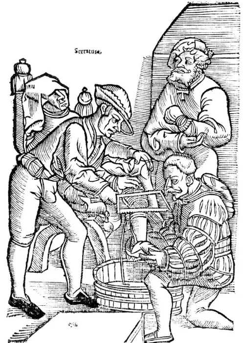 Framed Print : Amputation of a leg without anaesthetic, 1593 Framed Print : Amputation of a leg without anaesthetic, 1593