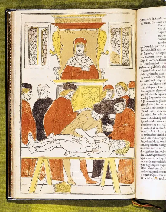 Framed Print : Anatomy lecture at Padua, Italy, 1483 Framed Print : Anatomy lecture at Padua, Italy, 1483
