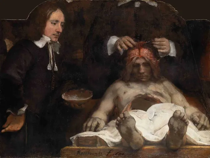 Framed Print : The Anatomy Lesson of Dr. Jan Deijman, 1656. Artist: Rembrandt van Rhijn (1606-1669) Framed Print : The Anatomy Lesson of Dr. Jan Deijman, 1656. Artist: Rembrandt van Rhijn (1606-1669)