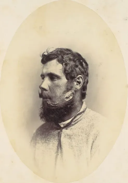 Framed Print : Andrew Wagoner, 1865. Creator: Reed Brockway Bontecou Framed Print : Andrew Wagoner, 1865. Creator: Reed Brockway Bontecou