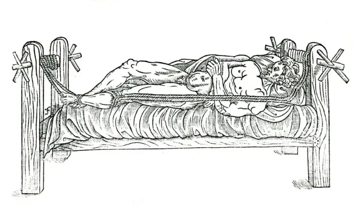 Framed Print : Apparatus for reducing dislocations, 1544 Framed Print : Apparatus for reducing dislocations, 1544