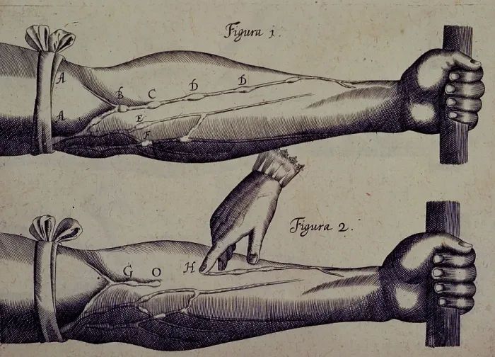 Framed Print : Two arms, and a finger pointing towards a vein, 1628. Creator: Unknown Framed Print : Two arms, and a finger pointing towards a vein, 1628. Creator: Unknown