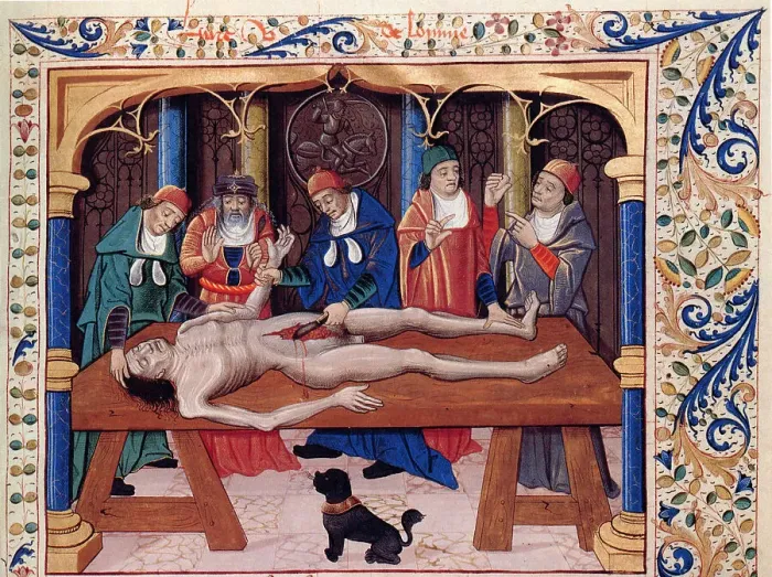 Framed Print : Autopsy. From Livre des propriétés des choses by Barthélemy l'Anglais, 15th century. Creator: Anonymous Framed Print : Autopsy. From Livre des propriétés des choses by Barthélemy l'Anglais, 15th century. Creator: Anonymous