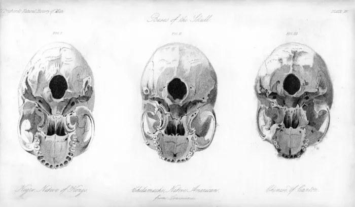 Framed Print : Base of the skull, 1848 Framed Print : Base of the skull, 1848