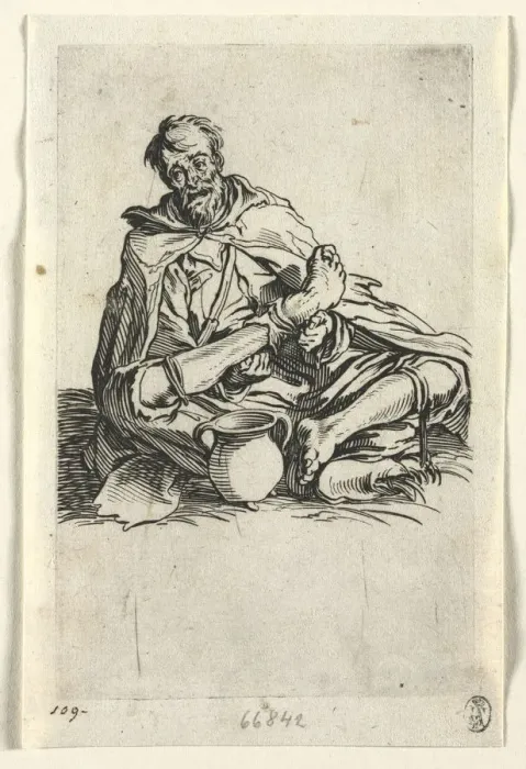 Framed Print : The Beggars: Malingerer, c. 1623. Creator: Jacques Callot (French, 1592-1635) Framed Print : The Beggars: Malingerer, c. 1623. Creator: Jacques Callot (French, 1592-1635)