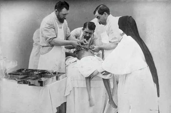 Framed Print : Binding arteries of Hindoo twins after operation, 1902. Creator: Bain News Service Framed Print : Binding arteries of Hindoo twins after operation, 1902. Creator: Bain News Service