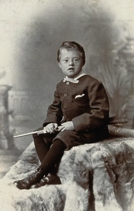 Framed Print : A boy with Down's syndrome, holding a rifle and sitting on a fur carpet, c1900 Framed Print : A boy with Down's syndrome, holding a rifle and sitting on a fur carpet, c1900