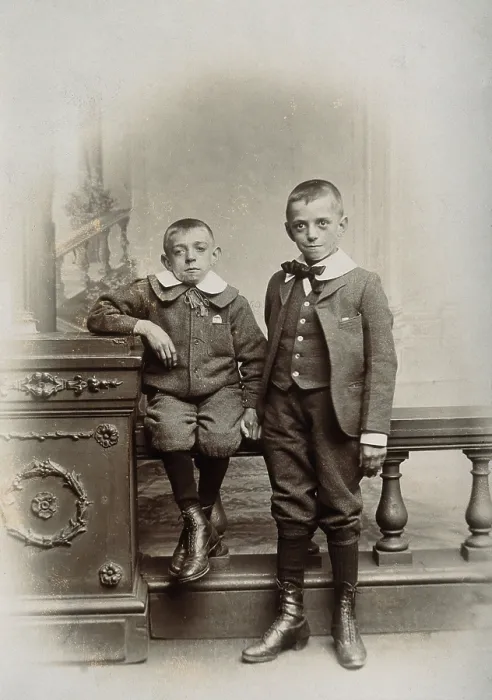 Framed Print : Two boys, one sitting and one standing: the former appears physically deformed, 1899. Creator: Unknown Framed Print : Two boys, one sitting and one standing: the former appears physically deformed, 1899. Creator: Unknown
