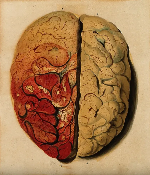 Framed Print : Brain: view from above, showing the gyri, with one hemisphere covered with pia mater, 1820-1827. Creator: Unknown Framed Print : Brain: view from above, showing the gyri, with one hemisphere covered with pia mater, 1820-1827. Creator: Unknown