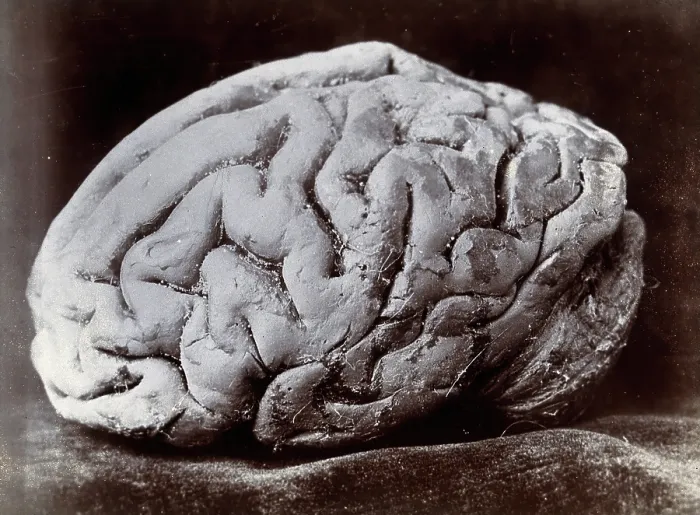 Framed Print : A brain, viewed from the side, supposedly from a subject with mental deficiency. Creator: N. Goulton May Framed Print : A brain, viewed from the side, supposedly from a subject with mental deficiency. Creator: N. Goulton May