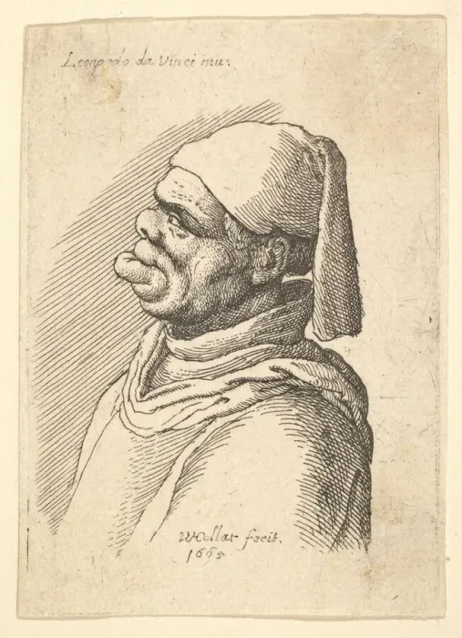Framed Print : Bust of a deformed man with a hat and a fat, protruding lower lip in profile to left Framed Print : Bust of a deformed man with a hat and a fat, protruding lower lip in profile to left
