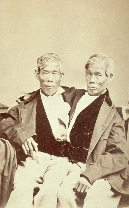 Framed Print : Chang and Eng, conjoined twins, seated, c1860. Creator: Unknown