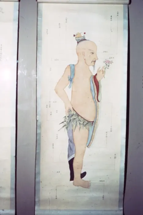 Framed Print : Chinese Acupuncture Chart Framed Print : Chinese Acupuncture Chart