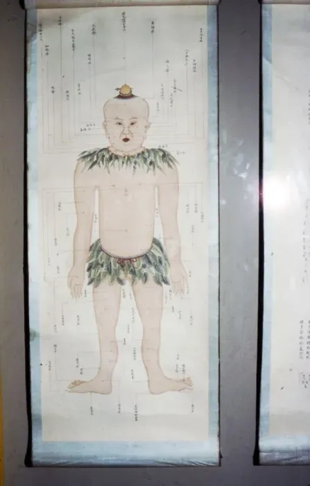 Framed Print : Chinese Acupuncture Chart, Front View Framed Print : Chinese Acupuncture Chart, Front View