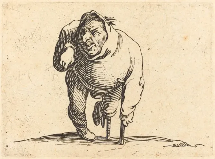 Framed Print : Cripple with Crutch and Wooden Leg, c. 1622. Creator: Jacques Callot Framed Print : Cripple with Crutch and Wooden Leg, c. 1622. Creator: Jacques Callot