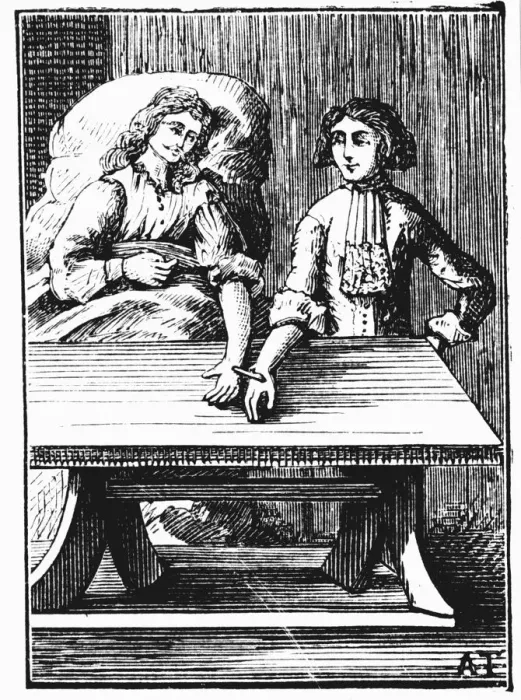 Framed Print : Direct person-to-person blood transfusion performed at the wrist, 1679 Framed Print : Direct person-to-person blood transfusion performed at the wrist, 1679