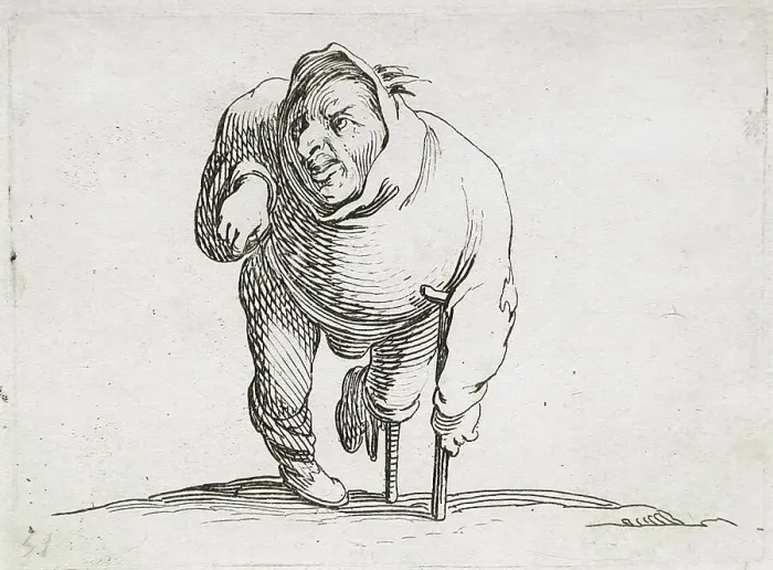 Framed Print : A Disabled Man with a Crutch and a Wooden Leg, 1616. Creator: Jacques Callot Framed Print : A Disabled Man with a Crutch and a Wooden Leg, 1616. Creator: Jacques Callot