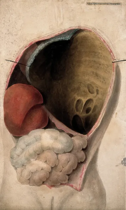 Framed Print : A dissected thorax with a collection of pus in the cavity, c1824. Creator: Unknown Framed Print : A dissected thorax with a collection of pus in the cavity, c1824. Creator: Unknown