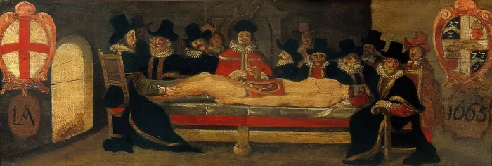 Framed Print : The dissection of a corpse before a company of surgeons, c1665. Creator: Unknown Framed Print : The dissection of a corpse before a company of surgeons, c1665. Creator: Unknown